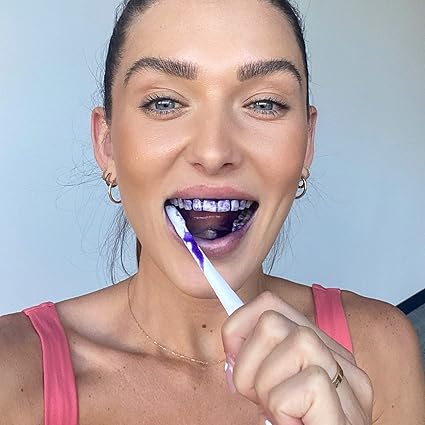 Hismile V34 Teeth Brightening